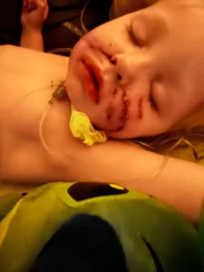 dog bite healing